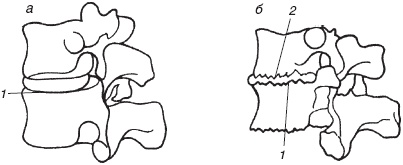 Иллюстрация к книге — Остеохондроз и плоскостопие у мужчин. Супермен и соломинка. Профилактика, диагностика, лечение [_4.jpg]