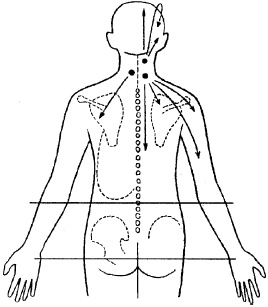 Иллюстрация к книге — Остеохондроз и плоскостопие у мужчин. Супермен и соломинка. Профилактика, диагностика, лечение [_7.jpg]