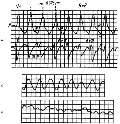 Иллюстрация к книге — Полный медицинский справочник фельдшера [Autogen_eBook_id19.jpg]