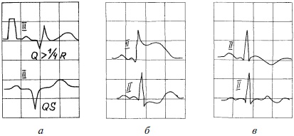Иллюстрация к книге — Полный медицинский справочник фельдшера [Autogen_eBook_id21.jpg]