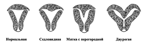 Иллюстрация к книге — Бесплодие – не приговор! [_17.jpg]