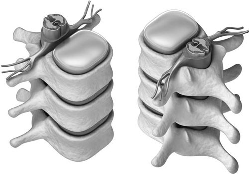 Иллюстрация к книге — Отложение солей. Диагностика и лечение [i_003.jpg]