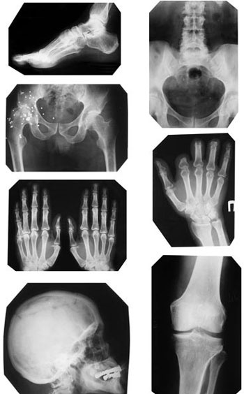 Иллюстрация к книге — Отложение солей. Диагностика и лечение [i_019.jpg]