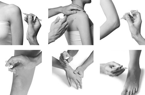 Иллюстрация к книге — Отложение солей. Диагностика и лечение [i_023.jpg]