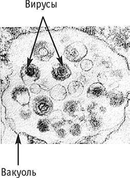 Иллюстрация к книге — Многоликий вирус. Тайны скрытых инфекций [i_014.jpg]