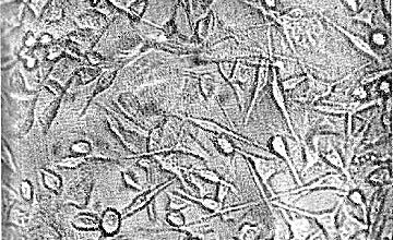 Иллюстрация к книге — Многоликий вирус. Тайны скрытых инфекций [i_029.jpg]