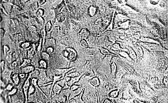 Иллюстрация к книге — Многоликий вирус. Тайны скрытых инфекций [i_030.jpg]