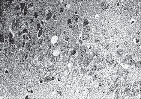 Иллюстрация к книге — Многоликий вирус. Тайны скрытых инфекций [i_035.jpg]