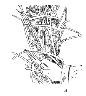 Иллюстрация к книге — Все об обрезке и прививке деревьев и кустарников [Autogen_eBook_id7.jpg]