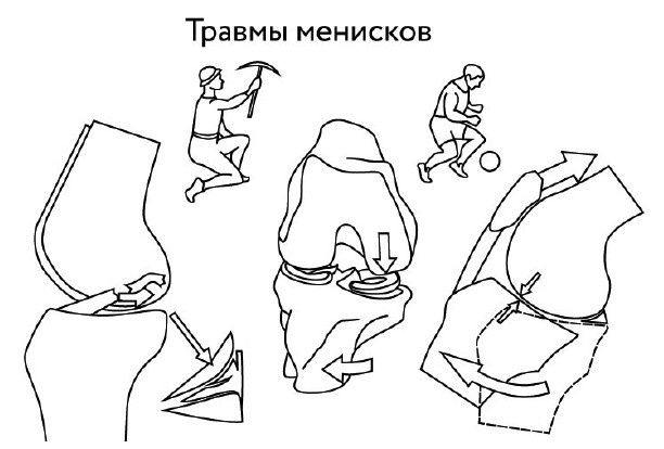 Иллюстрация к книге — 1000 ответов на вопросы, как вернуть здоровье [i_062.jpg]