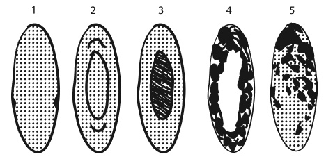 Иллюстрация к книге — Глаукома и катаракта. Лечение и профилактика [i_003.jpg]