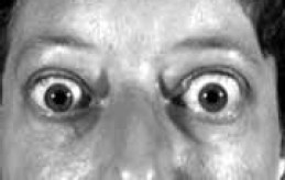 Иллюстрация к книге — Заболевания щитовидной железы. Лечение и профилактика [i_013.jpg]