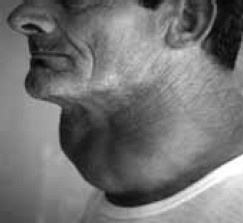 Иллюстрация к книге — Заболевания щитовидной железы. Лечение и профилактика [i_014.jpg]