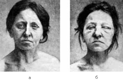 Иллюстрация к книге — Заболевания щитовидной железы. Лечение и профилактика [i_016.jpg]