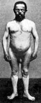 Иллюстрация к книге — Заболевания щитовидной железы. Лечение и профилактика [i_021.jpg]