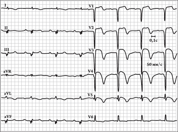 Иллюстрация к книге — Карманный справочник медицинских анализов [Autogen_eBook_id23.jpg]