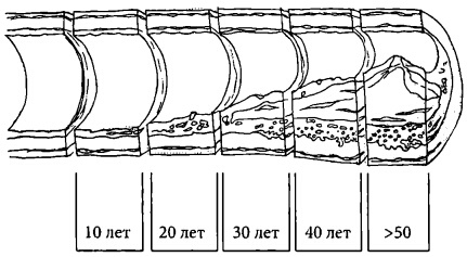 Иллюстрация к книге — Здоровое сердце и сосуды [i_012.jpg]