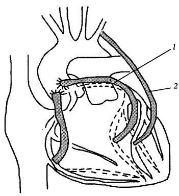 Иллюстрация к книге — Здоровое сердце и сосуды [i_014.jpg]