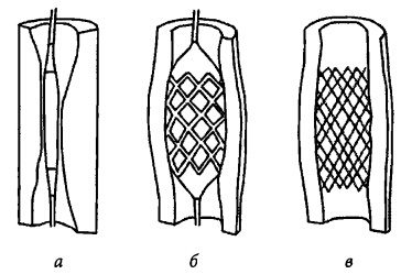 Иллюстрация к книге — Здоровое сердце и сосуды [i_015.jpg]