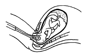 Иллюстрация к книге — Буду мамой! Все о беременности и первом годе жизни малыша. 1000 ответов на 1000 главных вопросов [i_060.jpg]