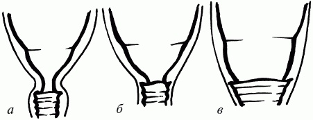 Иллюстрация к книге — 1001 вопрос будущей мамы. Большая книга ответов на все вопросы [i_059.jpg]