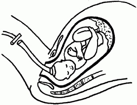 Иллюстрация к книге — 1001 вопрос будущей мамы. Большая книга ответов на все вопросы [i_080.jpg]