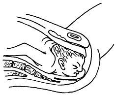 Иллюстрация к книге — Все, что будущая мама хочет знать, но не знает, у кого спросить [i_041.jpg]