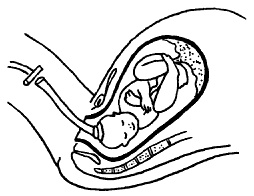 Иллюстрация к книге — Все, что будущая мама хочет знать, но не знает, у кого спросить [i_072.jpg]