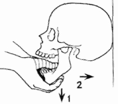 Иллюстрация к книге — Неотложная помощь. Справочник для родителей. Всегда под рукой [i_060.jpg]