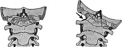 Иллюстрация к книге — Все о позвоночнике для тех, кому за... [_108.jpg]