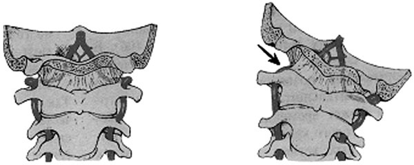 Иллюстрация к книге — Гимнастика для сосудов [Autogen_eBook_id7.jpg]
