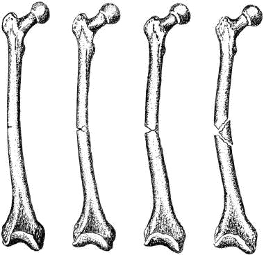 Иллюстрация к книге — Человек в экстремальной ситуации [i_070.jpg]