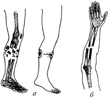 Иллюстрация к книге — Человек в экстремальной ситуации [i_077.jpg]