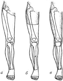 Иллюстрация к книге — Человек в экстремальной ситуации [i_087.jpg]