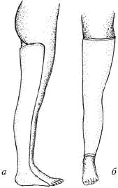 Иллюстрация к книге — Человек в экстремальной ситуации [i_088.jpg]