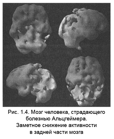 Иллюстрация к книге — Измени свой мозг - изменится и тело! [i_005.jpg]