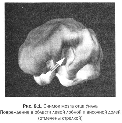 Иллюстрация к книге — Измени свой мозг - изменится и тело! [i_033.jpg]