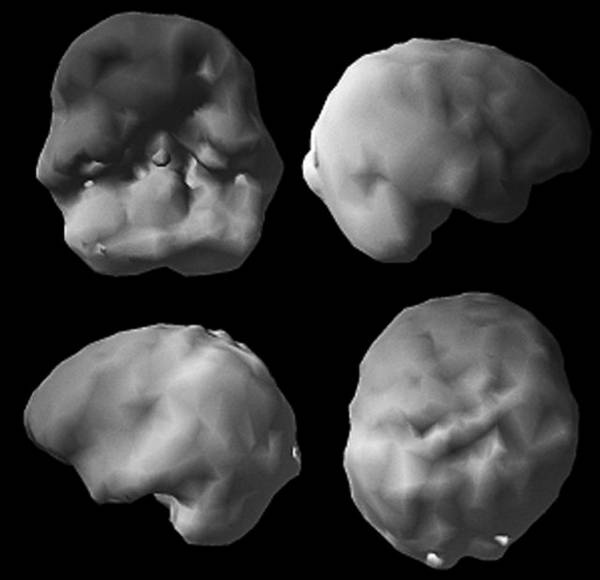 Иллюстрация к книге — Измени свой мозг - изменится и возраст! [i_013.jpg]