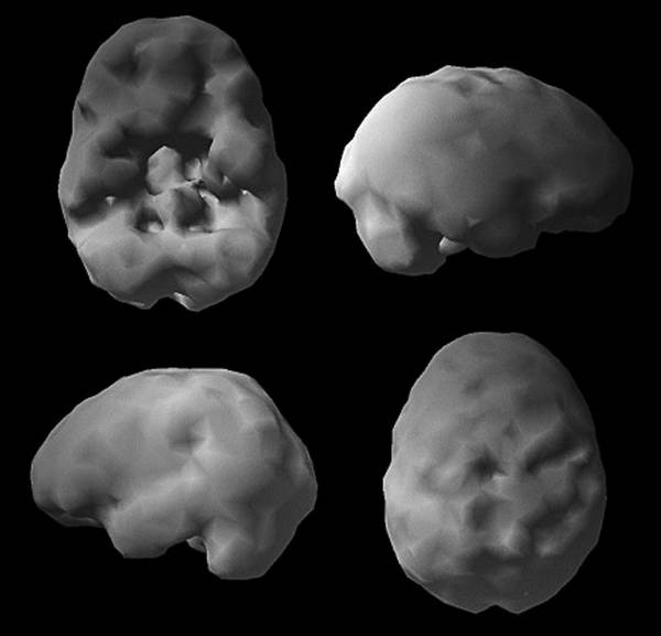 Иллюстрация к книге — Измени свой мозг - изменится и возраст! [i_018.jpg]