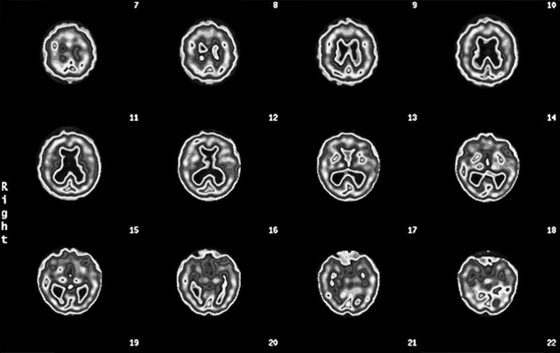 Иллюстрация к книге — Измени свой мозг - изменится и возраст! [i_019.jpg]