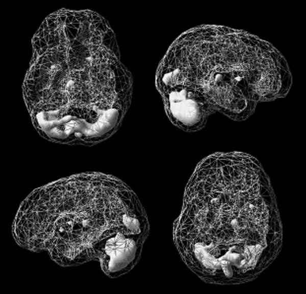 Иллюстрация к книге — Измени свой мозг - изменится и возраст! [i_039.jpg]