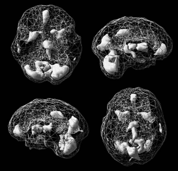 Иллюстрация к книге — Измени свой мозг - изменится и возраст! [i_040.jpg]