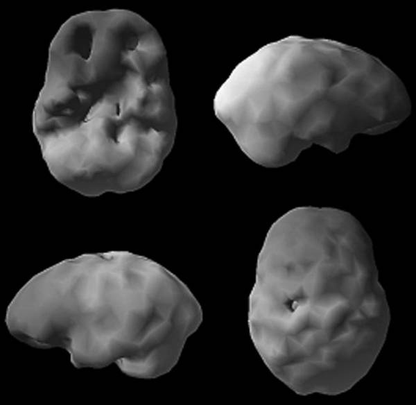 Иллюстрация к книге — Измени свой мозг - изменится и возраст! [i_047.jpg]