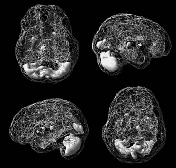 Иллюстрация к книге — Измени свой мозг - изменится и возраст! [i_048.jpg]