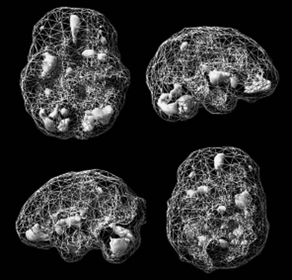 Иллюстрация к книге — Измени свой мозг - изменится и возраст! [i_049.jpg]