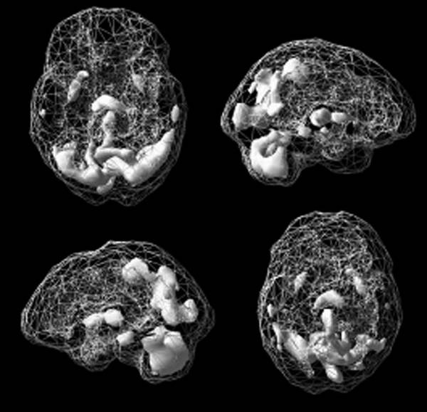 Иллюстрация к книге — Измени свой мозг - изменится и возраст! [i_051.jpg]