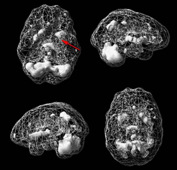 Иллюстрация к книге — Измени свой мозг - изменится и возраст! [i_053.jpg]