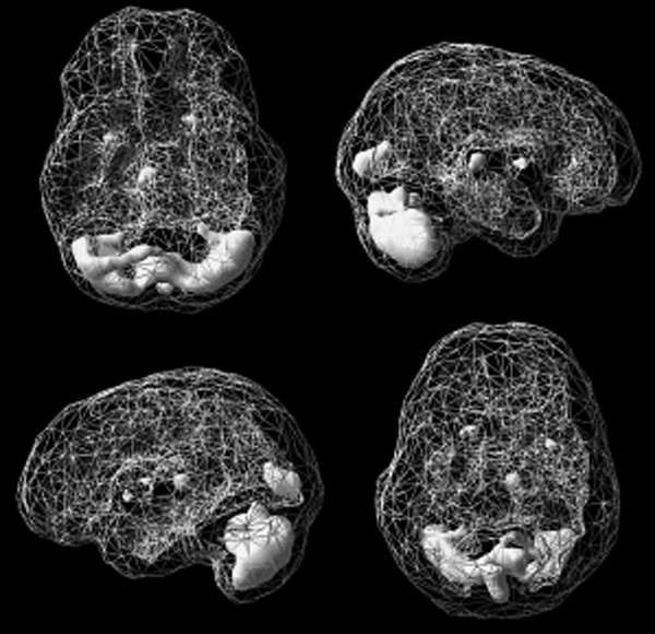 Иллюстрация к книге — Измени свой мозг - изменится и возраст! [i_058.jpg]