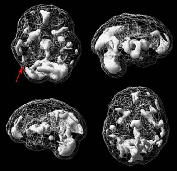 Иллюстрация к книге — Измени свой мозг - изменится и возраст! [i_059.jpg]