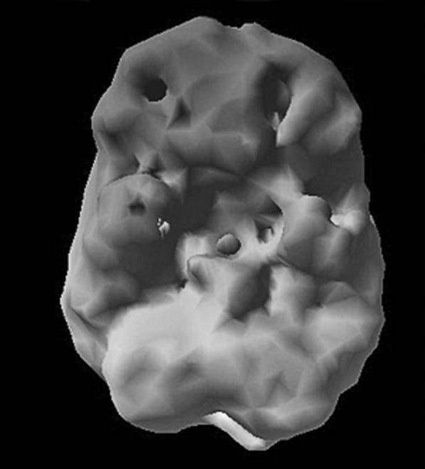 Иллюстрация к книге — Измени свой мозг - изменится и возраст! [i_062.jpg]